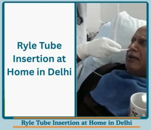 Nurse for Ryle Tube Insertion at Home in Delhi: Everything one should know about it