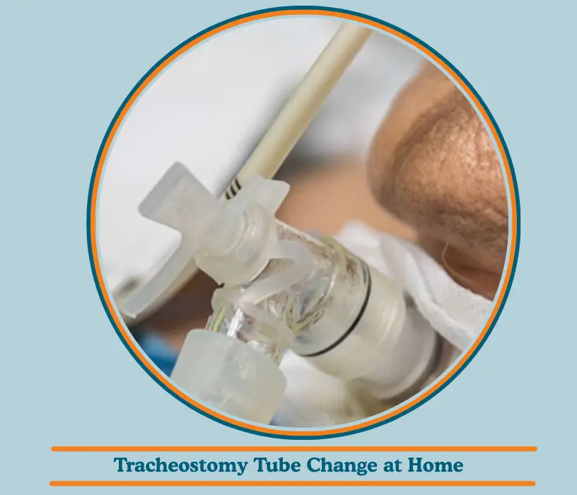 Tracheostomy Tube Change at Home